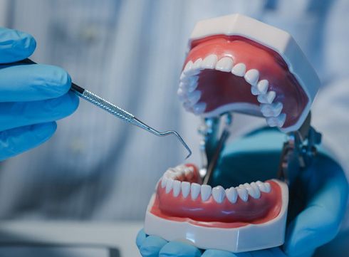 a dentist holding a model of dentures