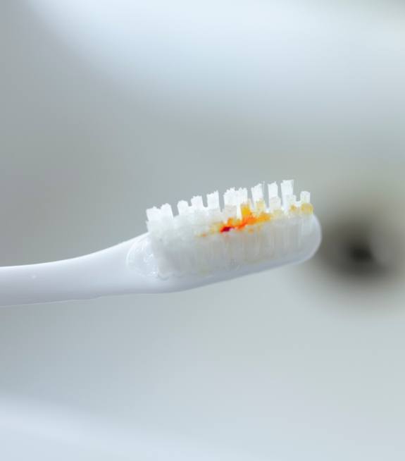 Blood on toothbrush a symptom of untreated gum disease