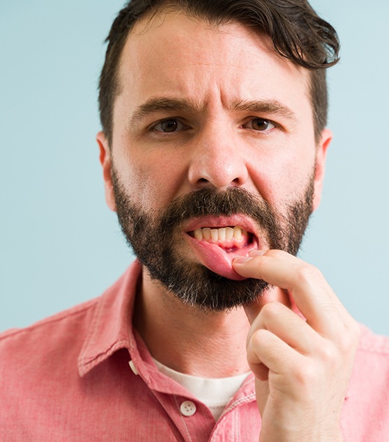 Man pointing to his inflamed gums before LANAP treatment in Corpus Christi